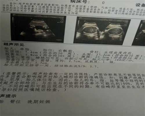 上海代生包生双胞胎，美国试管婴儿攻略